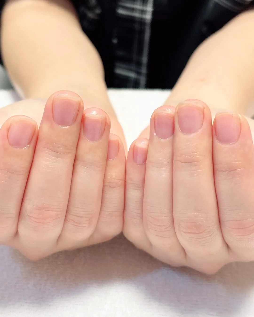 【間違ったケアかも…】